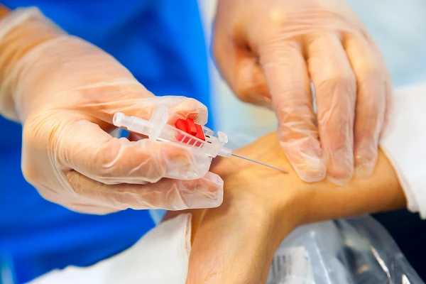 Global Needles and Catheters Market 2020 - Key Insights